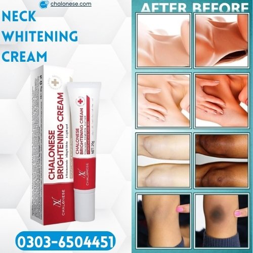 Neck Bleaching Cream